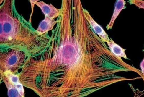 自体成纤维细胞美容抗衰技术